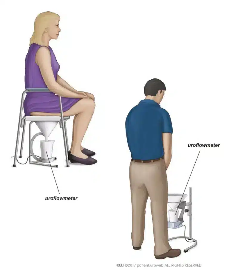 قياس تدفق البول